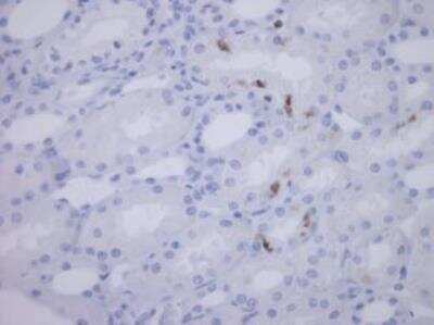 Immunohistochemistry: Lipocalin-2/NGAL Antibody (14) - BSA Free [NBP2-41364]