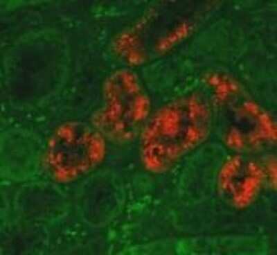 Immunohistochemistry: Lipocalin-2/NGAL Antibody (29) - BSA Free [NBP1-05183] - NGAL expression in the ischemia-reperfusion injured mouse kidney; detected with anti-mouse NGAL antibody at dilution of 1:1000. Image and data supplied by Prof. Gueler, Medizinische Hochschule Hannover.