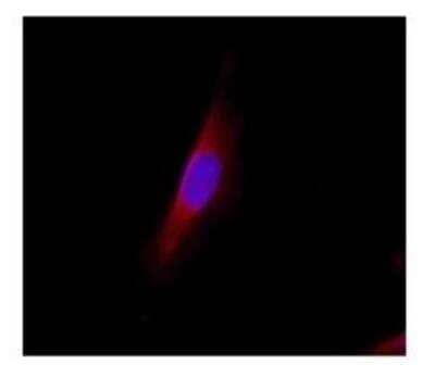 Immunocytochemistry/Immunofluorescence: Lipocalin-2/NGAL Antibody [NBP1-45682] - Immunofluorescence analysis of 3T3 cells using Anti-Lipocalin-2/NGAL
