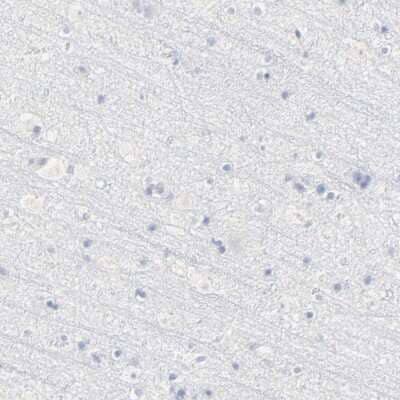 Immunohistochemistry-Paraffin: Lipocalin-2/NGAL Antibody [NBP1-90331] - Staining of human cerebral cortex shows low expression as expected.