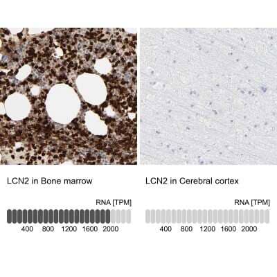 Immunohistochemistry-Paraffin: Lipocalin-2/NGAL Antibody [NBP1-90331] - Staining in human bone marrow and cerebral cortex tissues using anti-LCN2 antibody. Corresponding LCN2 RNA-seq data are presented for the same tissues.