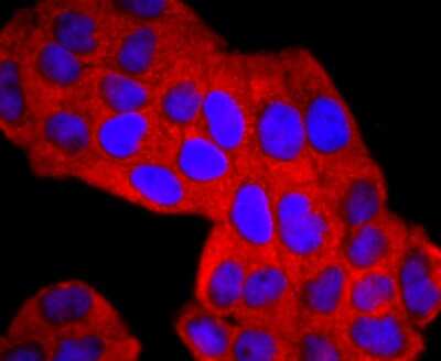 Immunocytochemistry/Immunofluorescence: Lipocalin-2/NGAL Antibody (JM10-67) [NBP2-66935] - Staining Lipocalin-2 in Hela cells (red). The nuclear counter stain is DAPI (blue). Cells were fixed in paraformaldehyde, permeabilised with 0.25% Triton X100/PBS.