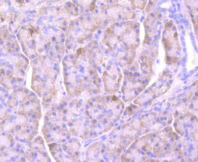 Immunohistochemistry-Paraffin: Lipocalin-2/NGAL Antibody (JM10-67) [NBP2-66935] - Analysis of paraffin-embedded human pancreas tissue using anti-Lipocalin-2 antibody. Counter stained with hematoxylin.