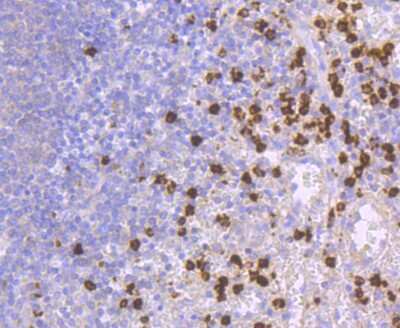 Immunohistochemistry-Paraffin: Lipocalin-2/NGAL Antibody (JM10-67) [NBP2-66935] - Analysis of paraffin-embedded human spleen tissue using anti-Lipocalin-2 antibody. Counter stained with hematoxylin.