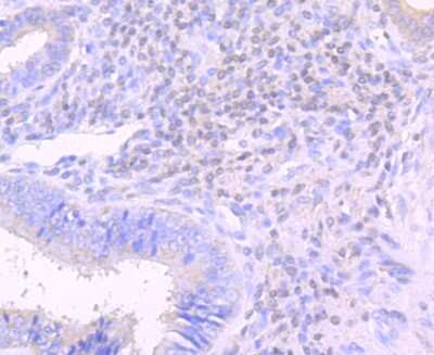 Immunohistochemistry-Paraffin: Lipocalin-2/NGAL Antibody (JM10-67) [NBP2-66935] - Analysis of paraffin-embedded human uterus tissue using anti-Lipocalin-2 antibody. Counter stained with hematoxylin.