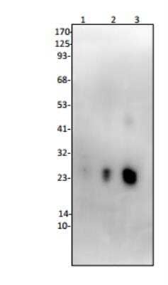 Western Blot: Lipocalin-2/NGAL Antibody [NBP1-45682] - Lane 1. Mouse recombinant Lipocalin-2 / LCN2-2 ng Lane 2. Mouse recombinant Lipocalin-2 / LCN2-10 ng Lane 3. Mouse recombinant Lipocalin-2 / LCN2-50 ng