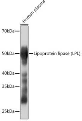 Western Blot: Lipoprotein Lipase/LPL Antibody (10E10P9) [NBP3-16334] - Western blot analysis of extracts of Human plasma, using Lipoprotein Lipase/LPL (LPL) Rabbit mAb (NBP3-16334) at 1:1000 dilution. Secondary antibody: HRP Goat Anti-Rabbit IgG (H+L) at 1:10000 dilution. Lysates/proteins: 25ug per lane. Blocking buffer: 3% nonfat dry milk in TBST. Detection: ECL Basic Kit. Exposure time: 3s.