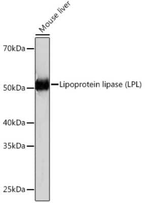 Western Blot: Lipoprotein Lipase/LPL Antibody (10E10P9) [NBP3-16334] - Western blot analysis of extracts of Mouse liver, using Lipoprotein Lipase/LPL (LPL) Rabbit mAb (NBP3-16334) at 1:1000 dilution. Secondary antibody: HRP Goat Anti-Rabbit IgG (H+L) at 1:10000 dilution. Lysates/proteins: 25ug per lane. Blocking buffer: 3% nonfat dry milk in TBST. Detection: ECL Basic Kit. Exposure time: 3min.