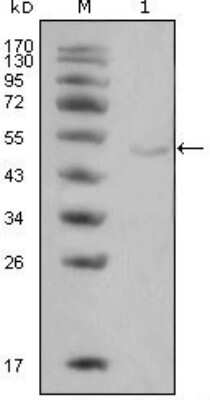 Western Blot: Lipoprotein Lipase/LPL Antibody (2C5) [NBP1-51565] - Western blot analysis using LPL mouse mAb against Hela cell lysate (1).