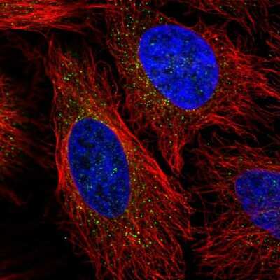 Immunocytochemistry/Immunofluorescence: Lipoprotein Lipase/LPL Antibody [NBP2-58366] - Staining of human cell line HeLa shows localization to vesicles.