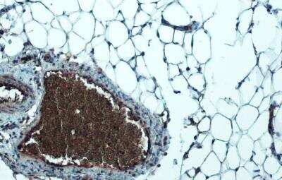 Immunohistochemistry-Paraffin: Lipoprotein Lipase/LPL Antibody [NBP1-32215] - Mouse white adipocyte. LPL stained by LPL antibody diluted at 1:500. Antigen Retrieval: Citrate buffer, pH 6.0, 15 min. 