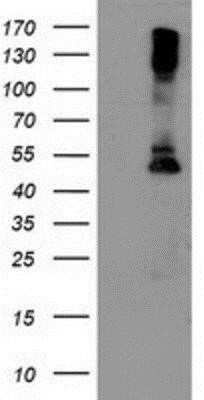 Western Blot: Lipoprotein Lipase/LPL Antibody (OTI3A10) - Azide and BSA Free [NBP2-71178] - HEK293T cells were transfected with the pCMV6-ENTRY control (Left lane) or pCMV6-ENTRY Lipoprotein lipase (Right lane) cDNA for 48 hrs and lysed. Equivalent amounts of cell lysates (5 ug per lane) were separated by SDS-PAGE and immunoblotted with anti-Lip