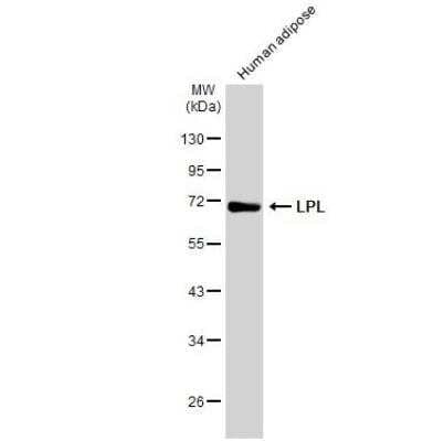 Western Blot: Lipoprotein Lipase/LPL Antibody [NBP1-32215] - Human tissue extract (30 ug) was separated by 10% SDS-PAGE, and the membrane was blotted with LPL antibody diluted at 1:1000. The HRP-conjugated anti-rabbit IgG antibody (NBP2-19301) was used to detect the primary antibody