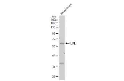 Western Blot: Lipoprotein Lipase/LPL Antibody [NBP2-19364] - Mouse tissue extract (50 ug) was separated by 10% SDS-PAGE, and the membrane was blotted with LPL antibody [N2C2], Internal diluted at 1:500. The HRP-conjugated anti-rabbit IgG antibody was used to detect the primary antibody.