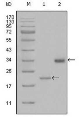 Western Blot: Lipoprotein a Antibody (8F6A9) [NBP1-51563] - Western blot analysis using LPA mouse mAb against truncated LPA-His recombinant protein (1) and truncated Trx-LPA(aa4330-4521) recombinant protein (2).