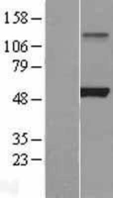 Western Blot: Lipoprotein lipase Overexpression Lysate (Adult Normal) [NBL1-12656] Left-Empty vector transfected control cell lysate (HEK293 cell lysate); Right -Over-expression Lysate for Lipoprotein lipase.