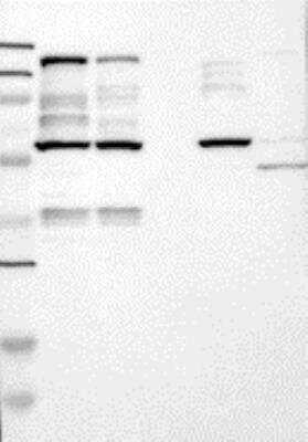 Western Blot: Liprin alpha 1 Antibody [21720002] - Samples:  Lane 1, Marker [kDa]: 250, 130, 95, 72, 55, 36, 28, 17, 11  Lane 2, RT-4 Lane 3, U-251MG sp Lane 4, Human Plasma Lane 5, Liver Lane 6, Tonsil , Target weight [kDa]:   136, 134 (splice variants)   Validation score:  2   Validation description: Supportive - Band of predicted size in kDa (+/-20%) with additional bands present.