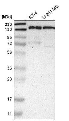 Western Blot: Liprin alpha 1 Antibody [NBP2-58915] - Western blot analysis in human cell line RT-4 and human cell line U-251 MG.