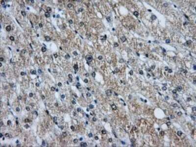 Immunohistochemistry: Livin Antibody (OTI1D12) - Azide and BSA Free [NBP2-72206] - Staining of paraffin-embedded liver tissue using anti-Livin mouse monoclonal antibody.