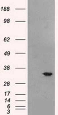 Western Blot: Livin Antibody (OTI1D12) - Azide and BSA Free [NBP2-72206] - HEK293T cells were transfected with the pCMV6-ENTRY control (Left lane) or pCMV6-ENTRY Livin (Right lane) cDNA for 48 hrs and lysed. Equivalent amounts of cell lysates (5 ug per lane) were separated by SDS-PAGE and immunoblotted with anti-Livin.