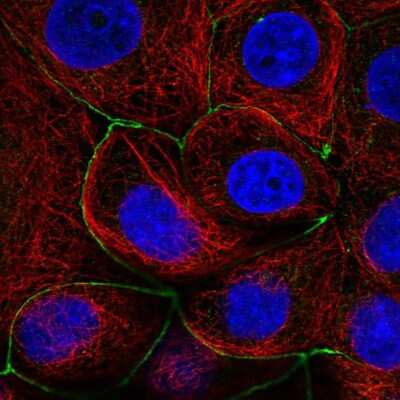 Immunocytochemistry/Immunofluorescence: Lnx1 Antibody [NBP2-58844] - Staining of human cell line MCF7 shows localization to cell junctions.