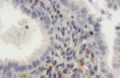 Immunohistochemistry-Paraffin: Low Density LRP Antibody [H00004035-B01P] - Analysis of purified antibody to LRP1 on formalin-fixed paraffin-embedded human endometrium. (antibody concentration 3 ug/ml)