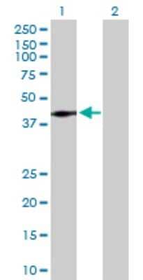 Western Blot: Low Density LRP Antibody [H00004035-D01P] - Analysis of LRP1 expression in transfected 293T cell line by LRP1 polyclonal antibody.Lane 1: LRP1 transfected lysate(31.60 KDa).Lane 2: Non-transfected lysate.
