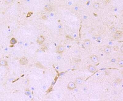 Immunohistochemistry-Paraffin: Lunapark Antibody (11-1) [NBP2-75557] - Analysis of paraffin-embedded mouse brain tissue using anti-Lnpk antibody. Counter stained with hematoxylin.