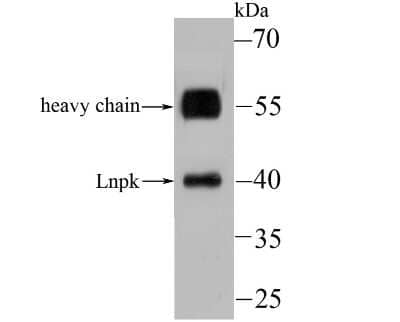 Western Blot: Lunapark Antibody (11-1) [NBP2-75557] - Analysis of Lnpk on mouse brain tissue lysate using anti-Lnpk antibody at 1/100 dilution.