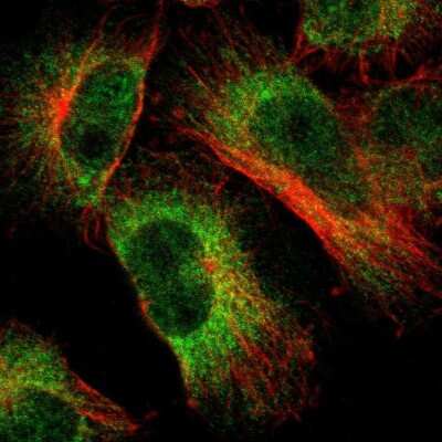 Immunocytochemistry/Immunofluorescence: Lunapark Antibody [NBP1-80637] - Staining of human cell line U-251 MG shows localization to nucleoplasm & endoplasmic reticulum. Antibody staining is shown in green.