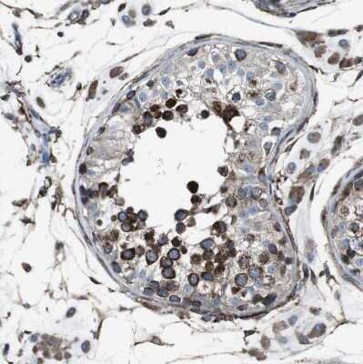 Immunohistochemistry-Paraffin: Lunapark Antibody [NBP1-80637] - Staining of human testis shows strong granular cytoplasmic positivity in cells in seminiferous ducts.