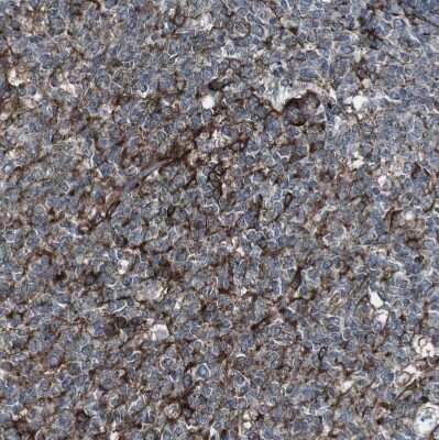 Immunohistochemistry-Paraffin: Lunapark Antibody [NBP1-80637] - Staining of human tonsil shows strong granular cytoplasmic positivity in germinal center cells.