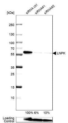 Western Blot: Lunapark Antibody [NBP1-80637] - Analysis in U-138MG cells transfected with control siRNA, target specific siRNA probe #1 and #2,. Remaining relative intensity is presented. Loading control: Anti-GAPDH.