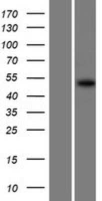 Western Blot: Lunapark Overexpression Lysate (Adult Normal) [NBP2-06199] Left-Empty vector transfected control cell lysate (HEK293 cell lysate); Right -Over-expression Lysate for Lunapark.