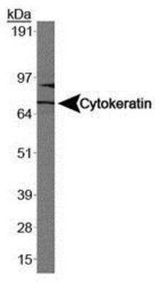 Western Blot: Lung Cancer Metastasis Antibody Pack 2vials [NBP1-78949] - Western blot analysis of Cytokeratin 1 in Caco-2 using NB100-2756.