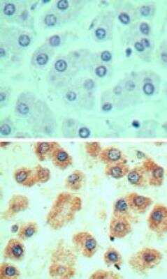 Immunohistochemistry-Paraffin: Ly-6G6F Antibody [NBP2-24668] - Analysis of G6D in formalin-fixed, paraffin-embedded human liver tissue using an isotype control (top) and this antibody (bottom) at 5 ug/ml.