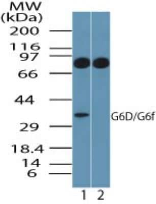 Western Blot: Ly-6G6F Antibody [NBP2-24668] - Analysis of G6D in human platelet lysate in the 1) absence and 2) presence of immunizing peptide using this antibody. 0 ug/ml.  Goat anti-rabbit Ig HRP secondary antibody and PicoTect ECL substrate solution were used for this test.