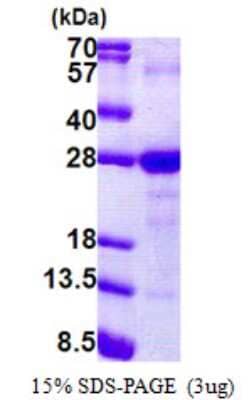 SDS-PAGE Recombinant Human Ly-6G6F His Protein