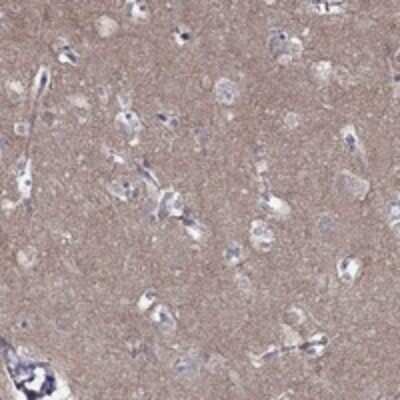 Immunohistochemistry-Paraffin: Ly-6H Antibody [NBP3-17515] - Staining of human hippocampus shows cytoplasmic positivity in neuropil.