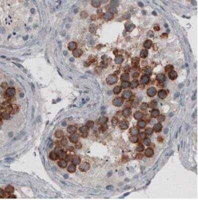 Immunohistochemistry-Paraffin: Ly6K Antibody (CL2433) [NBP2-36763] - Staining of human testis shows strong cytoplasmic immunoreactivity in a subset of cells in seminiferous tubules.