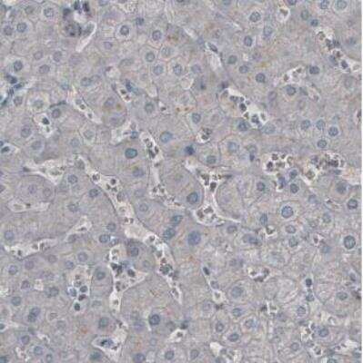 Immunohistochemistry-Paraffin: Ly6K Antibody (CL2433) [NBP2-36763] - Staining of human liver shows absence of immunoreactivity.