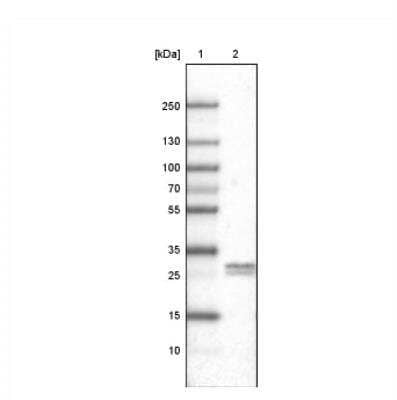 Western Blot: Ly6K Antibody (CL2433) [NBP2-36763] - Lane 1: Marker  [kDa].  Lane 2: Human testis tissue lysate