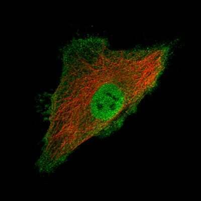 Immunocytochemistry/Immunofluorescence: Ly6K Antibody (CL2435) [NBP2-36764] - Staining of HeLa cells using the Anti-LY6K monoclonal antibody, showing specific staining in the plasma membrane and nucleoplasm. Microtubule- and nuclear probes are visualized in red and blue, respectively (where available).