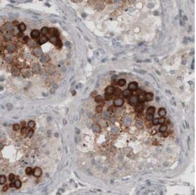 Immunohistochemistry-Paraffin: Ly6K Antibody (CL2435) [NBP2-36764] - Staining of human testis shows strong cytoplasmic immunoreactivity in a subset of cells in seminiferous tubules.