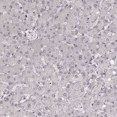Immunohistochemistry-Paraffin: Ly6K Antibody [NBP1-84340] - Staining of human liver shows no positivity in hepatocytes as expected.