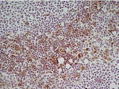 Immunohistochemistry: Ly-6C Antibody (ER-MP20) [NB100-65413] - Staining of a mouse lymph node cryosection.