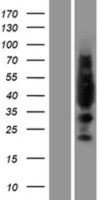 Western Blot: Lyl1 Overexpression Lysate (Adult Normal) [NBP2-07729] Left-Empty vector transfected control cell lysate (HEK293 cell lysate); Right -Over-expression Lysate for Lyl1.