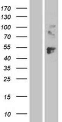 Western Blot LAG-3 Overexpression Lysate