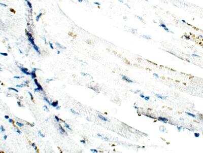 Immunohistochemistry-Paraffin: Lymphocyte Expansion Molecule Antibody [NBP3-12323] - Mouse Heart. 1:50 dilution in IHC blocking buffer. DAB (brown) staining and Hematoxylin QS (blue) counterstain. 40X magnification.