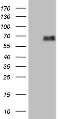 Western Blot: Lymphotoxin beta R/TNFRSF3 Antibody (3G10) [NBP2-45676] - Analysis of HEK293T cells were transfected with the pCMV6-ENTRY control (Left lane) or pCMV6-ENTRY Lymphotoxin beta R.